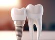 dental implants Whitby